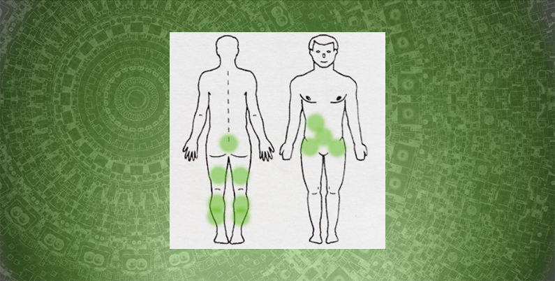 Гирудотерапия при варикозной болезни