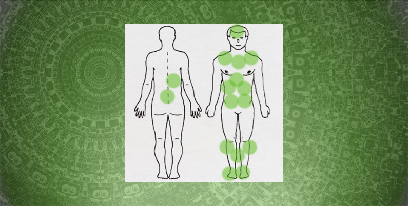 Гирудотерапия в комплексном лечении сахарного диабета 2 типа