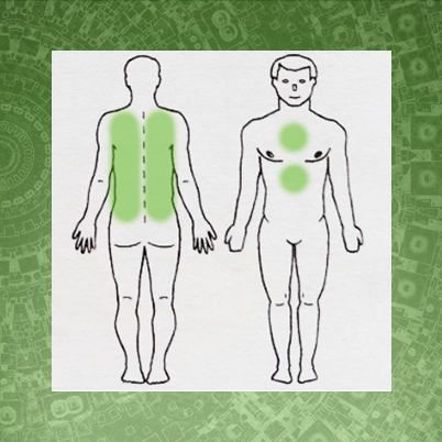 Иммуностимулирующая гирудотерапия